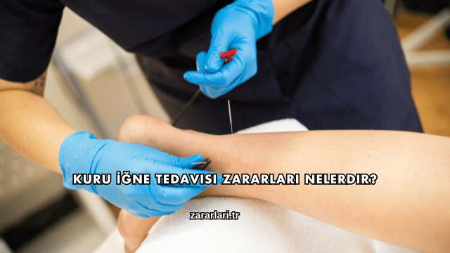 Kuru İğne Tedavisi Zararları Nelerdir?