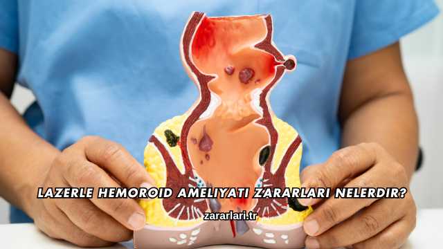 Lazerle Hemoroid Ameliyatı Zararları Nelerdir?