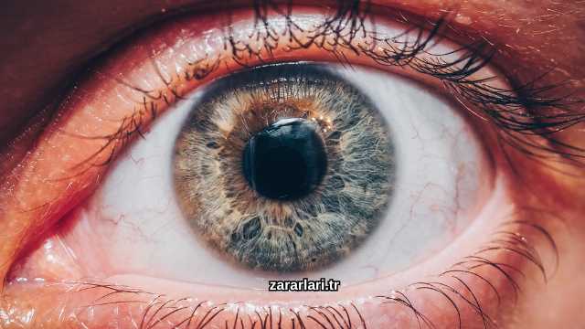 Lensin Zararları Nelerdir?