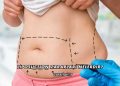 Liposuction Zararları Nelerdir?