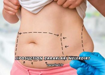 Liposuction Zararları Nelerdir?