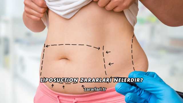 Liposuction Zararları Nelerdir?