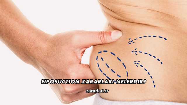 Liposuction Zararları Nelerdir?