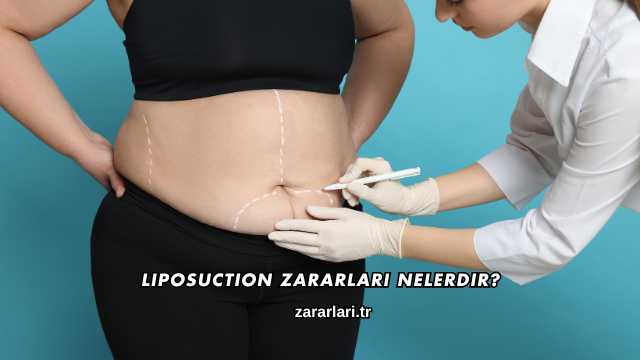 Liposuction Zararları Nelerdir?