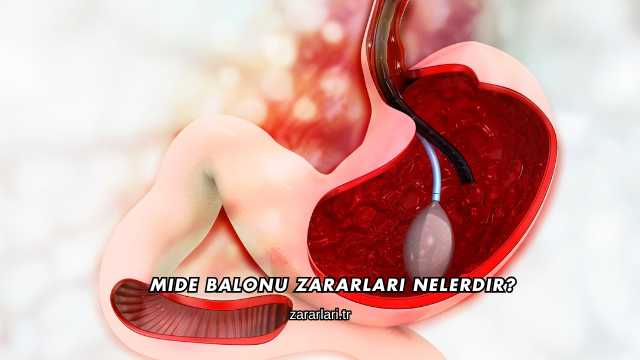 Mide Balonu Zararları Nelerdir?
