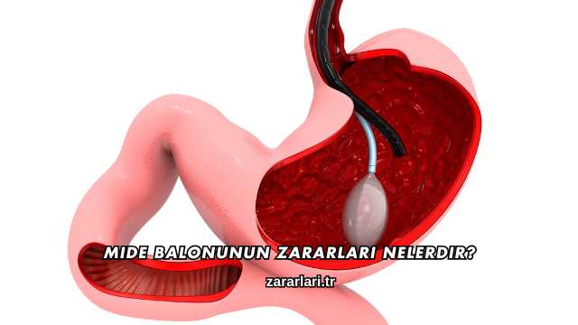Mide Balonunun Zararları Nelerdir?