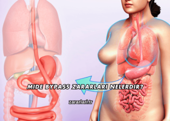 Mide Bypass Zararları Nelerdir?