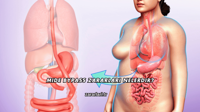Mide Bypass Zararları Nelerdir?