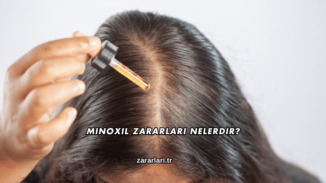 Minoxil Zararları Nelerdir?