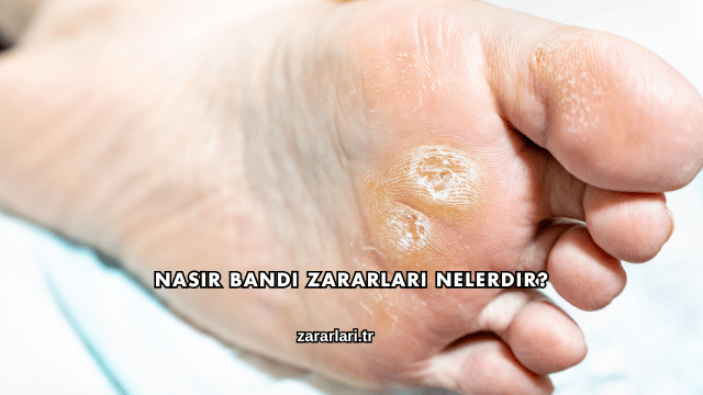 Nasır Bandı Zararları Nelerdir?