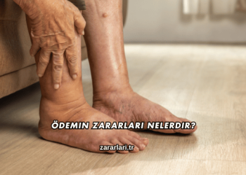 Ödemin Zararları Nelerdir?