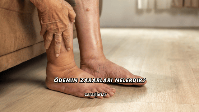 Ödemin Zararları Nelerdir?