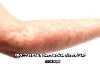 Proloterapi Zararları Nelerdir?