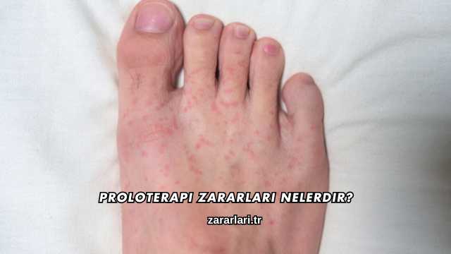Proloterapi Zararları Nelerdir?