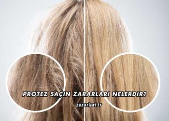 Protez Saçın Zararları Nelerdir?