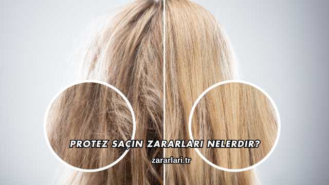 Protez Saçın Zararları Nelerdir?