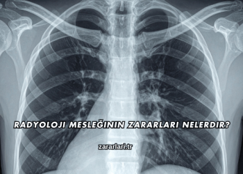 Radyoloji Mesleğinin Zararları Nelerdir?