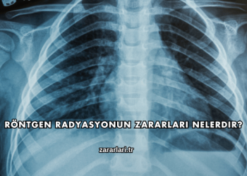 Röntgen Radyasyonun Zararları Nelerdir?