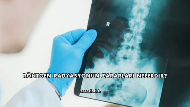 Röntgen Radyasyonun Zararları Nelerdir?