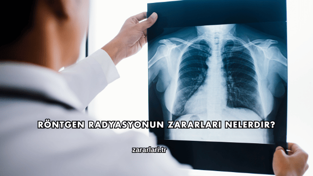 Röntgen Radyasyonun Zararları Nelerdir?