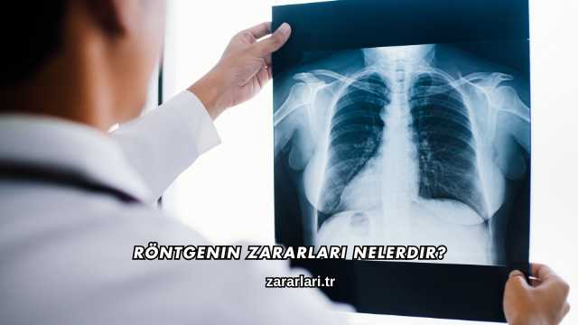 Röntgenin Zararları Nelerdir?