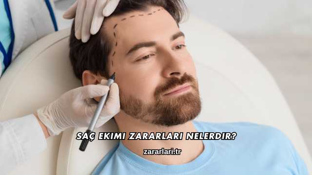 Saç Ekimi Zararları Nelerdir?