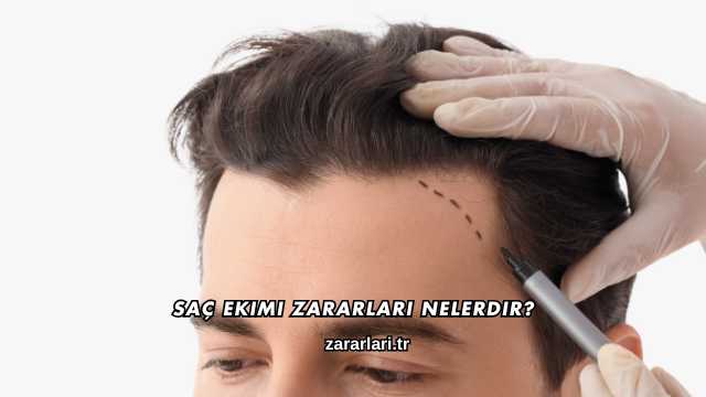 Saç Ekimi Zararları Nelerdir?