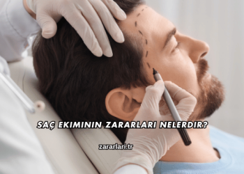 Saç Ekiminin Zararları Nelerdir?