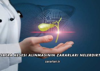 Safra Kesesi Alınmasının Zararları Nelerdir?