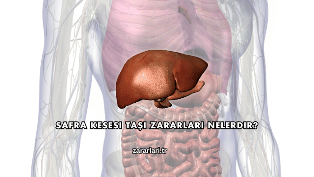 Safra Kesesi Taşı Zararları Nelerdir?