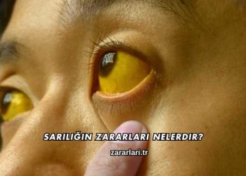 Sarılığın Zararları Nelerdir?