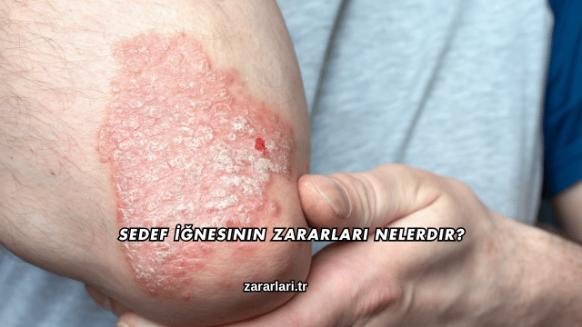 Sedef İğnesinin Zararları Nelerdir?