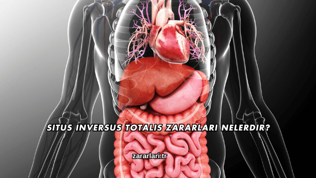 Situs Inversus Totalis Zararları Nelerdir?