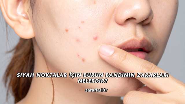 Siyah Noktalar İçin Burun Bandının Zararları Nelerdir?