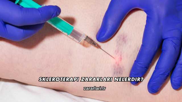 Skleroterapi Zararları Nelerdir?