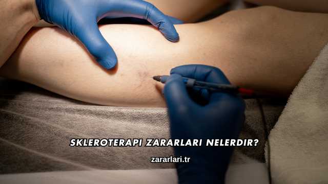 Skleroterapi Zararları Nelerdir?