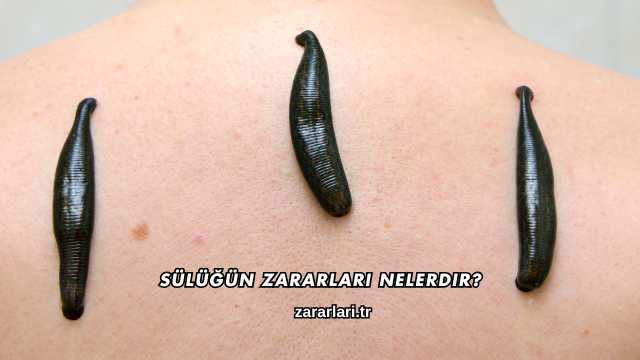 Sülüğün Zararları Nelerdir?