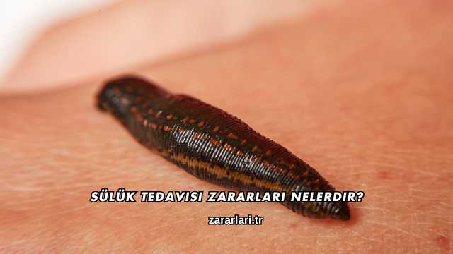 Sülük Tedavisi Zararları Nelerdir?