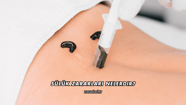 Sülük Zararları Nelerdir?
