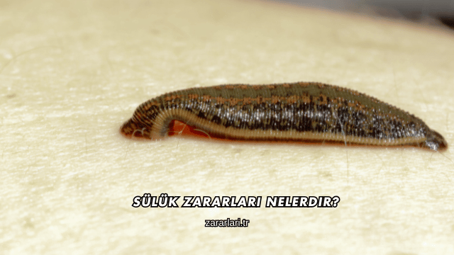 Sülük Zararları Nelerdir?