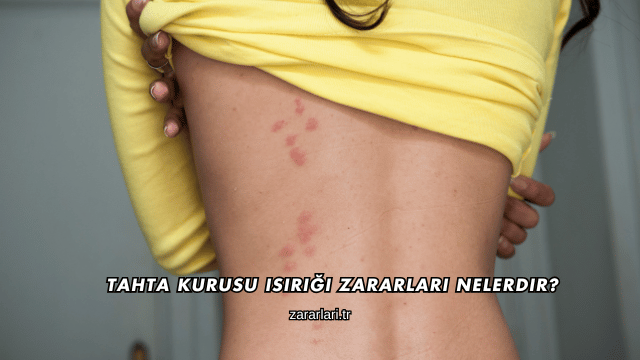 Tahta Kurusu Isırığı Zararları Nelerdir?