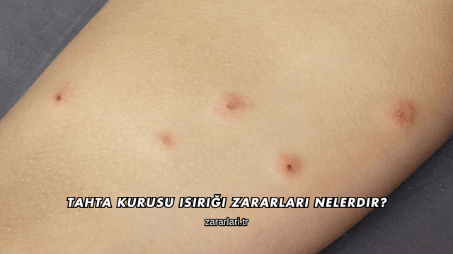 Tahta Kurusu Isırığı Zararları Nelerdir?
