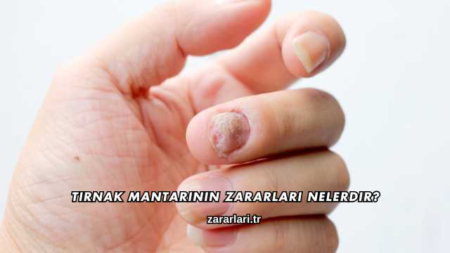 Tırnak Mantarının Zararları Nelerdir?