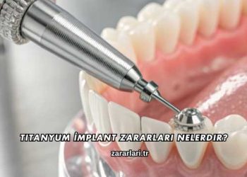Titanyum İmplant Zararları nelerdir?
