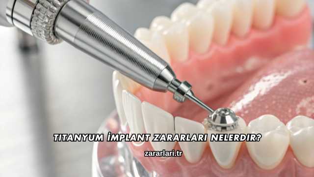 Titanyum İmplant Zararları nelerdir?