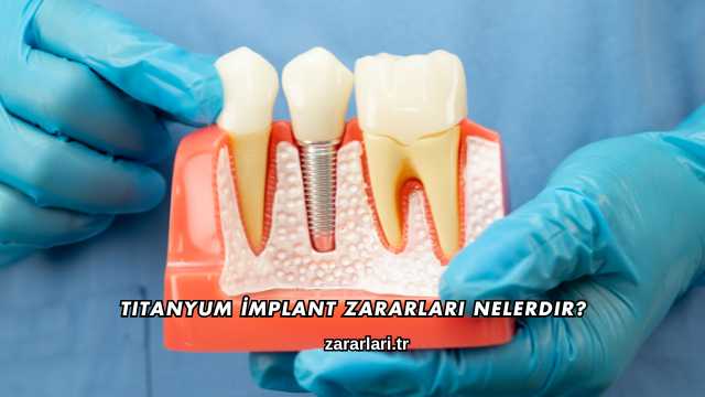 Titanyum İmplant Zararları nelerdir?