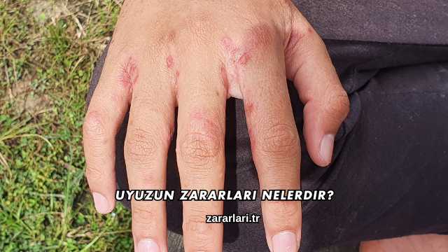 Uyuzun Zararları Nelerdir