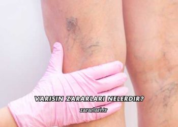 Varisin Zararları Nelerdir?
