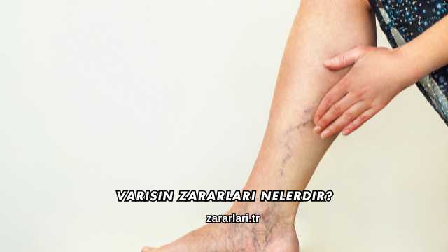 Varisin Zararları Nelerdir?