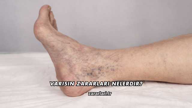 Varisin Zararları Nelerdir?